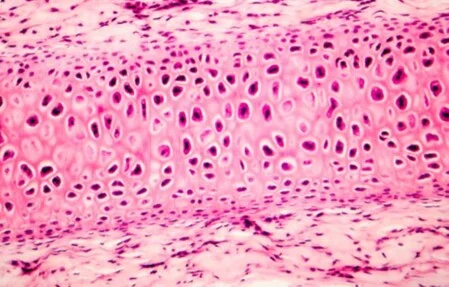 Effekt auf das Immunsystem