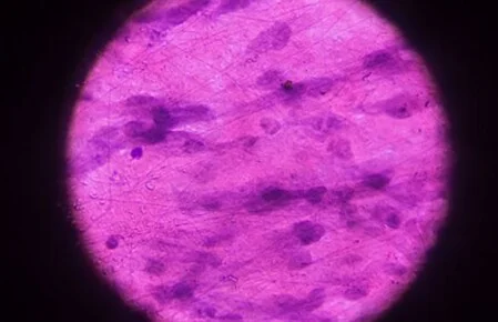 Effekt auf das Immunsystem